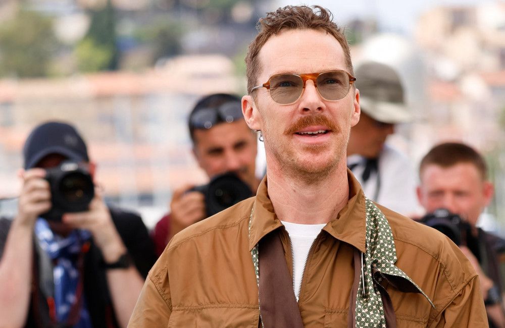 Benedict Cumberbatch: He suffered a painful injury while surfing