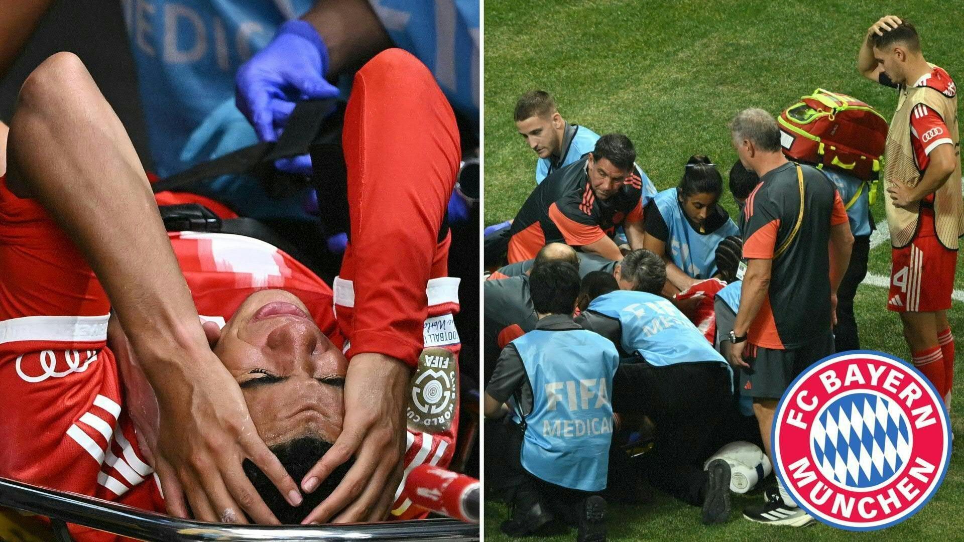 FC Bayern: Musiala erleidet Wadenbeinbruch