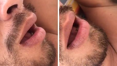 FLY LANDS IN MAN’S MOUTH AS HE SLEEPS