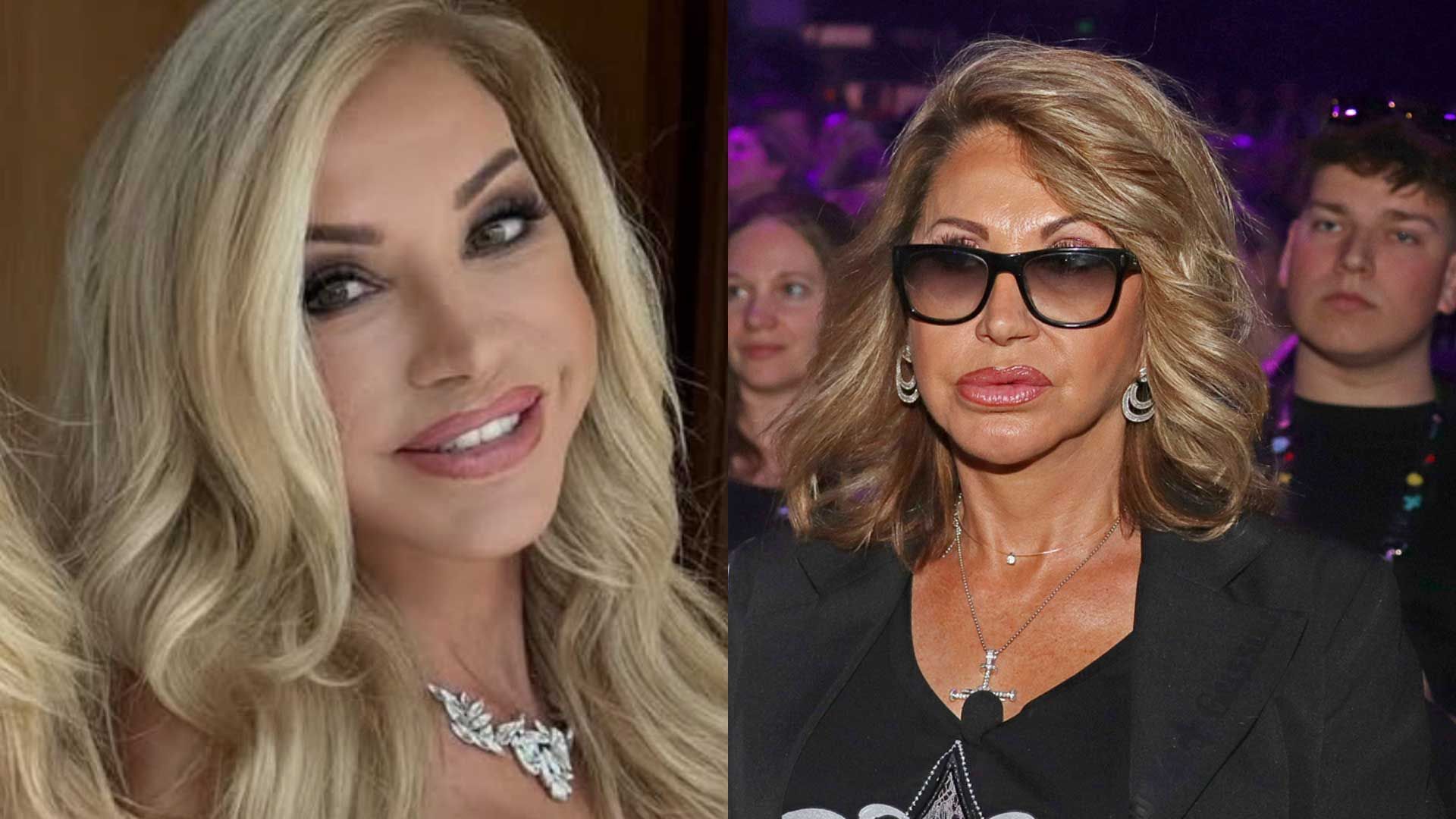 After Beauty Surgery: Fans hardly recognize Carmen Geiss