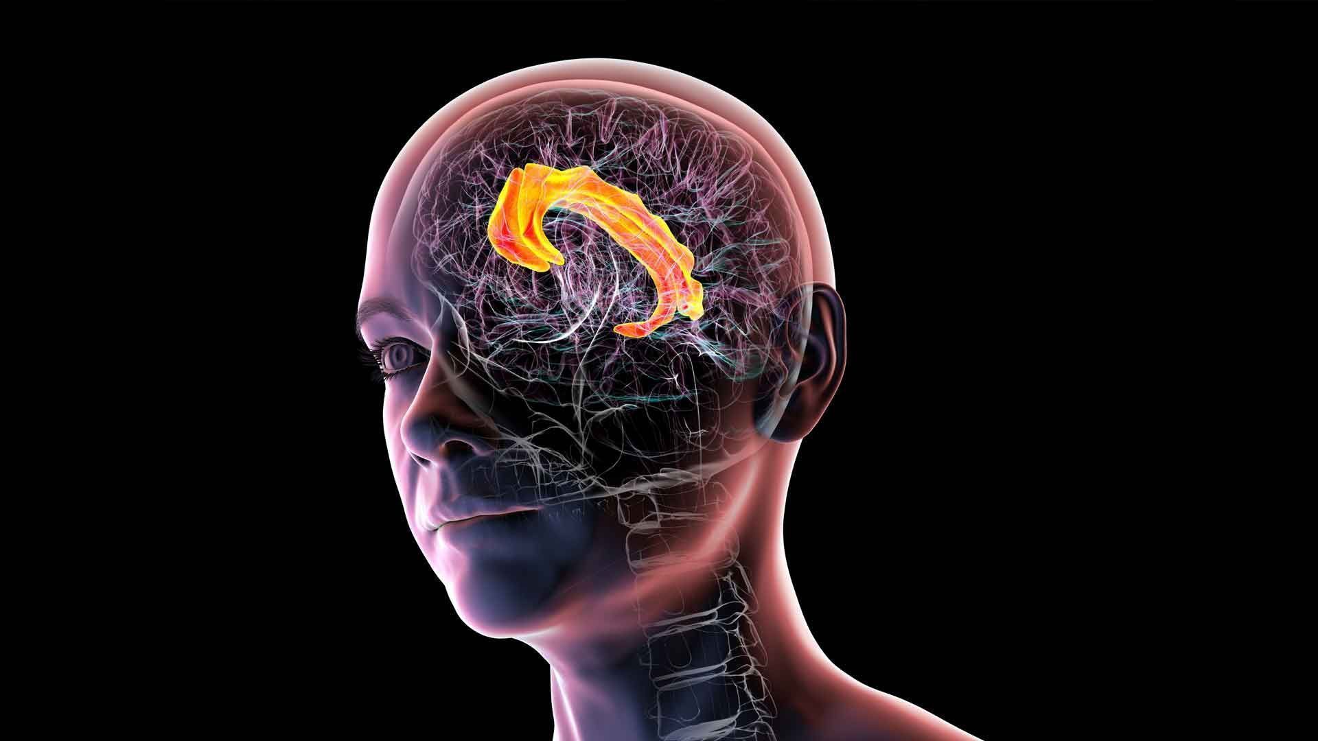 Understanding Tourette: What lies behind motor and vocal tics