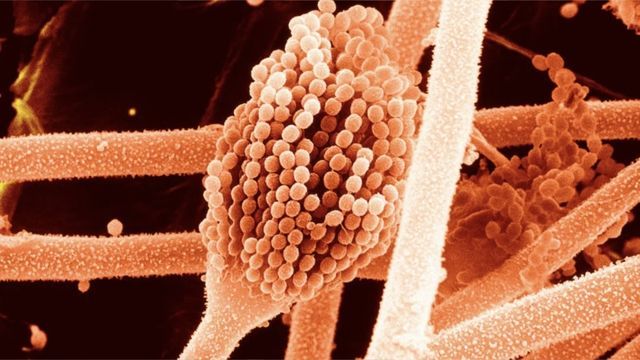 Forscher entdecken neues Mittel gegen Krebs – in Jahrtausende alten Gräbern