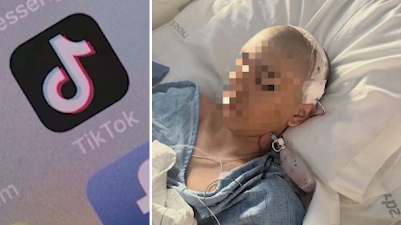 Gefährliche TikTok-Challenge: 13-Jähriger erleidet bei Prügelei Schädelbruch