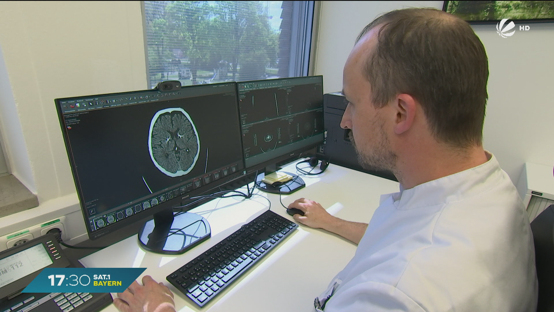 Mit Elektroden gegen Parkinson: So gewinnt Manfred seine Freiheit zurück