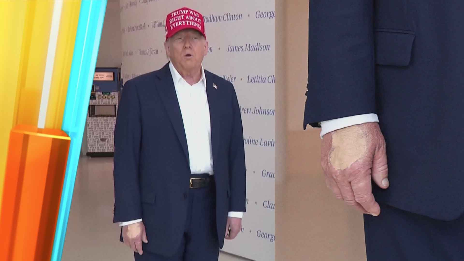 Video: Ist Donald Trump krank? Ein auffälliger Fleck auf seiner Hand wirft Fragen auf