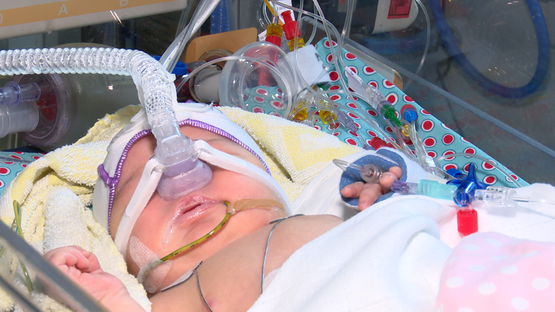 Video: Weltfrühchentag: 8.000 Frühgeburten in NRW