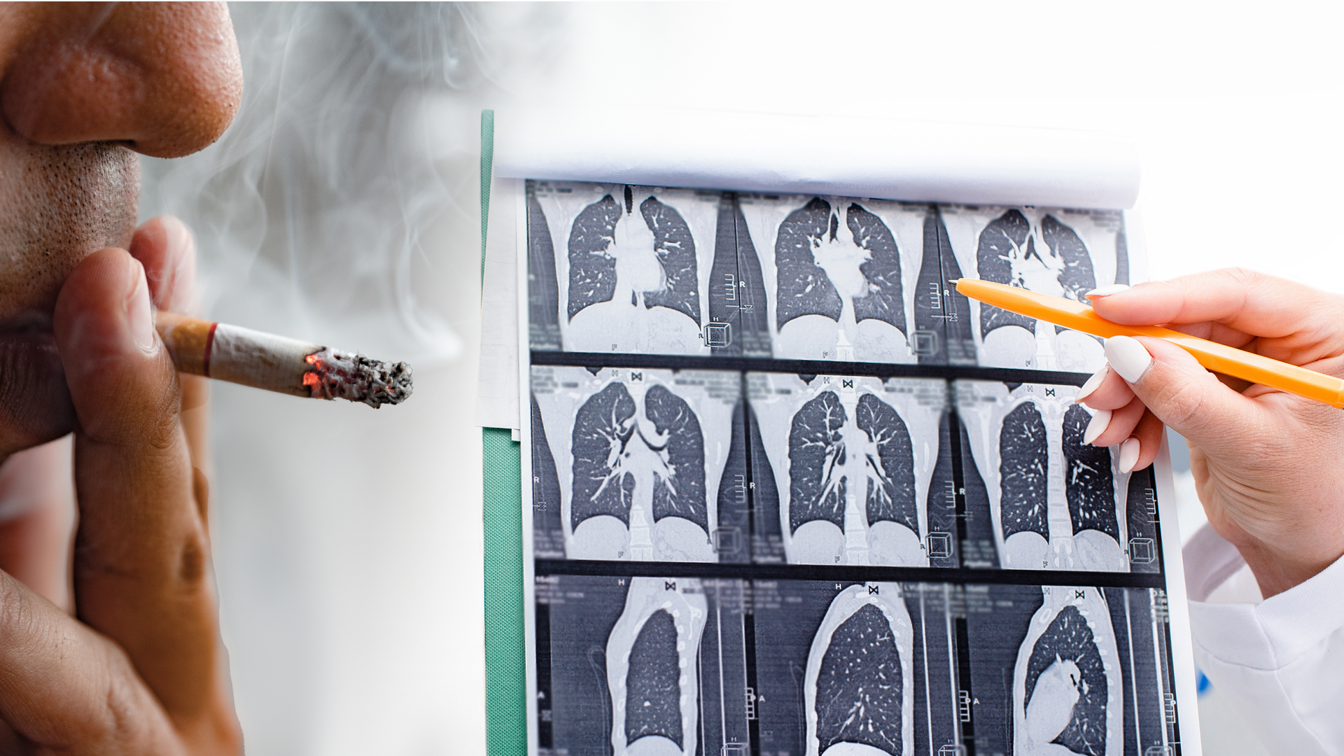 Video: Lungen-Check: Ab April neue Kassenleistung