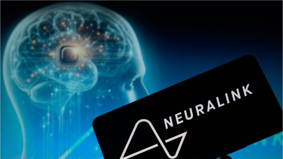 Chip von Musk im Hirn: So geht es Neuralink-Versuchsperson