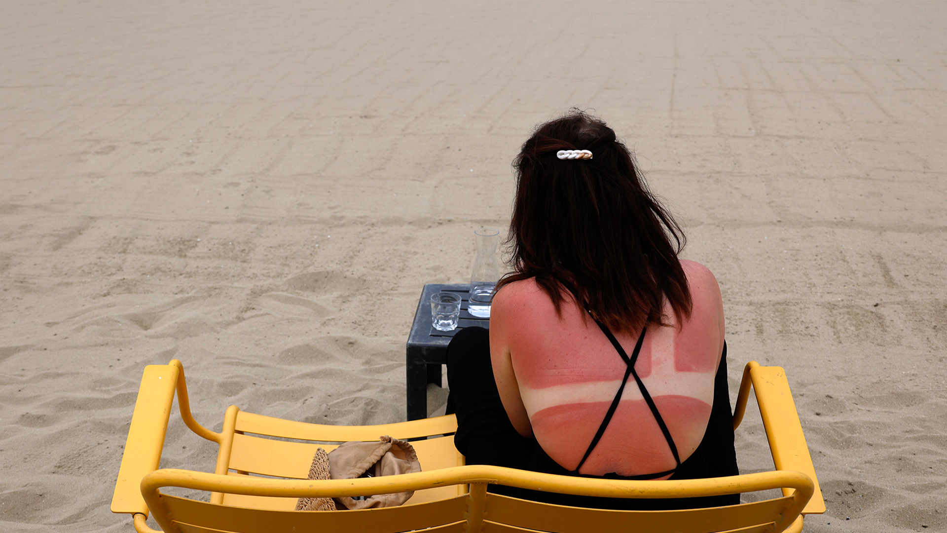 Video: Likes für Sonnenbrand